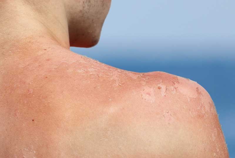 Revitaliza Tu Piel Tras El Verano Con Estos Sencillos Pasos