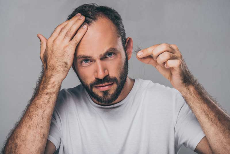 Evitar la caída del cabello en hombres: ¿Qué funciona?