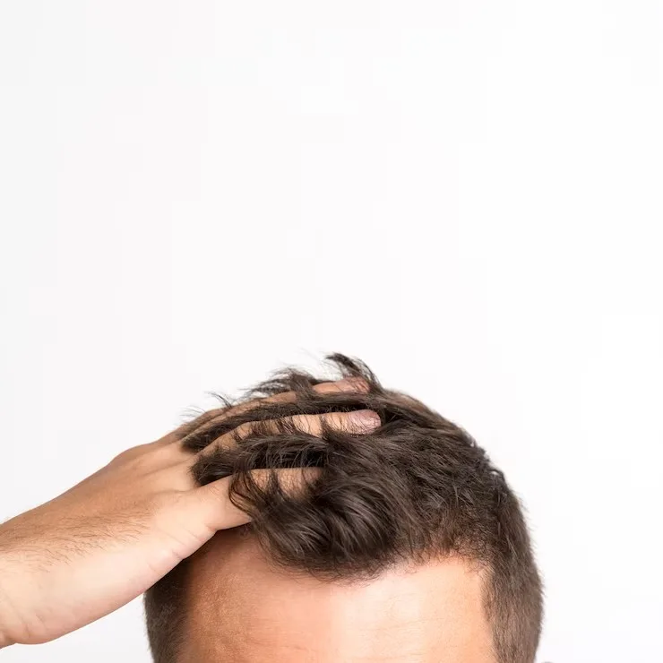 Cuidado capilar masculino: errores que causan caída del cabello