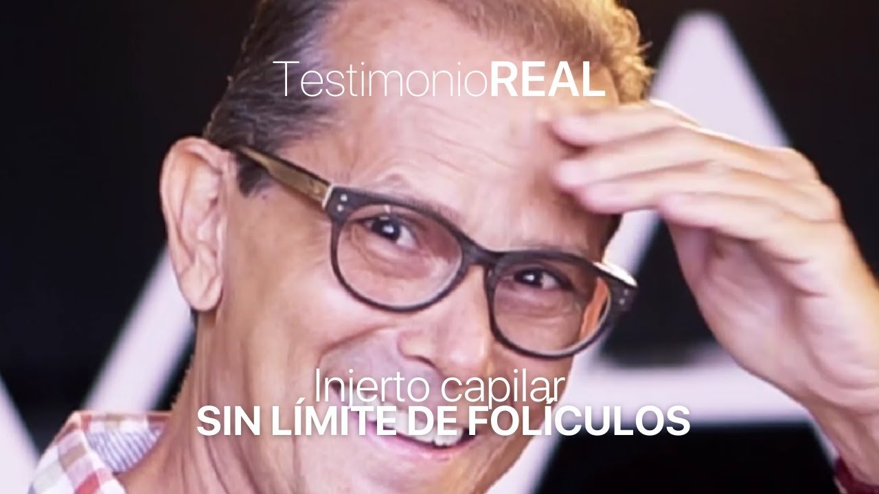 ¿Cuánto cuesta un injerto capilar? Precios 2022